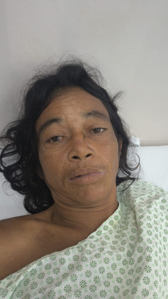 SES-AM_PACIENTE-SIRLEY-RODRIGUES_FOTO-DIVULGACAO-576×1024-1